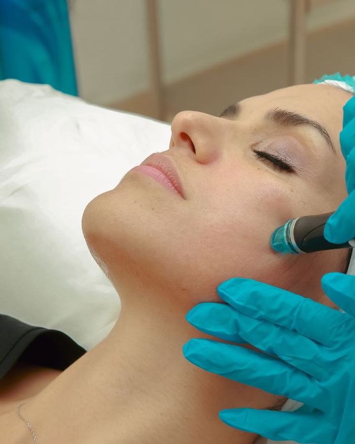 A Hydrafacial treatment on a woman's face